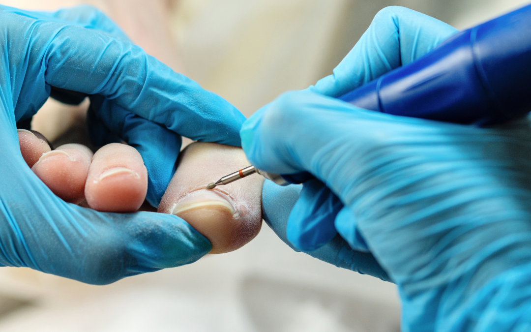 La Importancia de la Podología para Tu Bienestar Diario